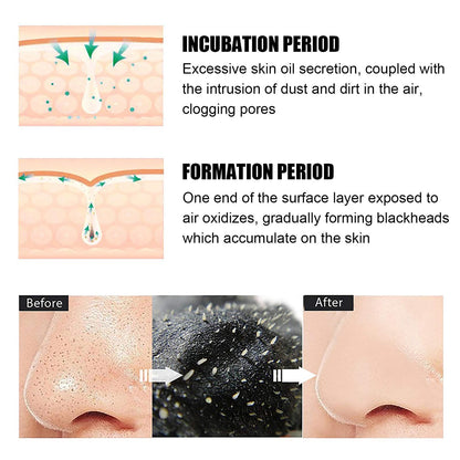 10 Pcs Blackhead Nose Patch Nose Pore Cleansing Strips Deep Cleansing Blackhead Remover Strips for Women Men