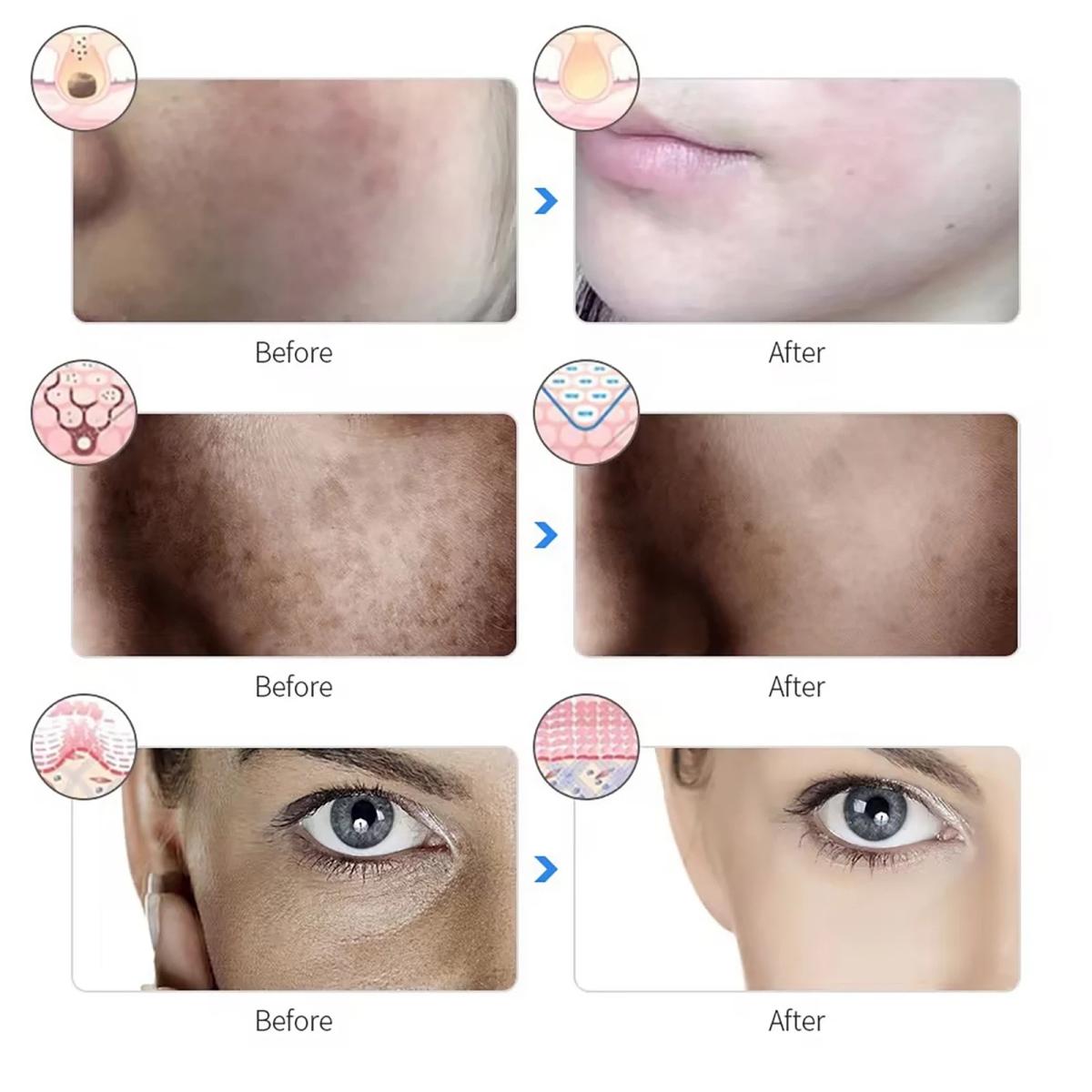 7 Color LED Light Photon Face Mask Neck Rejuvenation Skin Facial Wrinkle Therapy