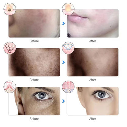 7 Color LED Light Photon Face Mask Neck Rejuvenation Skin Facial Wrinkle Therapy