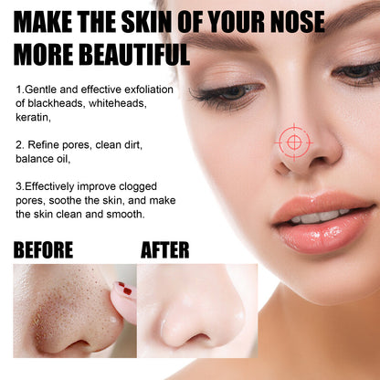 Blackhead Remover Tools -15G Blackhead Creamwith 40Pcs Blackhead Pore Strips