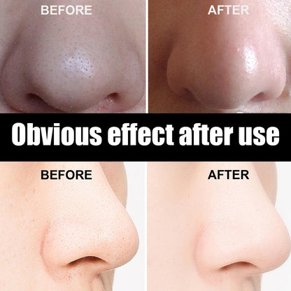 10 Pcs Blackhead Nose Patch Nose Pore Cleansing Strips Deep Cleansing Blackhead Remover Strips for Women Men