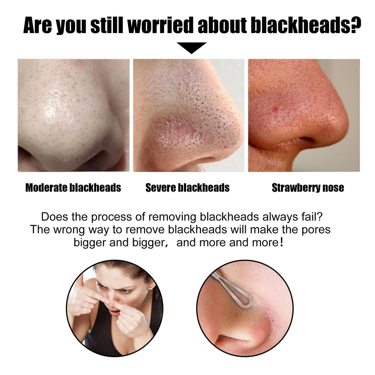 10 Pcs Blackhead Nose Patch Nose Pore Cleansing Strips Deep Cleansing Blackhead Remover Strips for Women Men