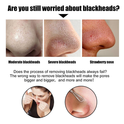 10 Pcs Blackhead Nose Patch Nose Pore Cleansing Strips Deep Cleansing Blackhead Remover Strips for Women Men